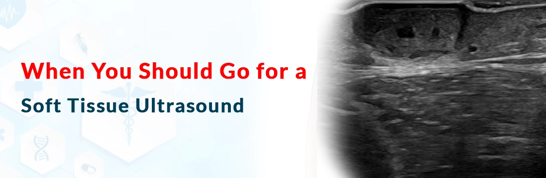 When You Should Go for a Soft Tissue Ultrasound